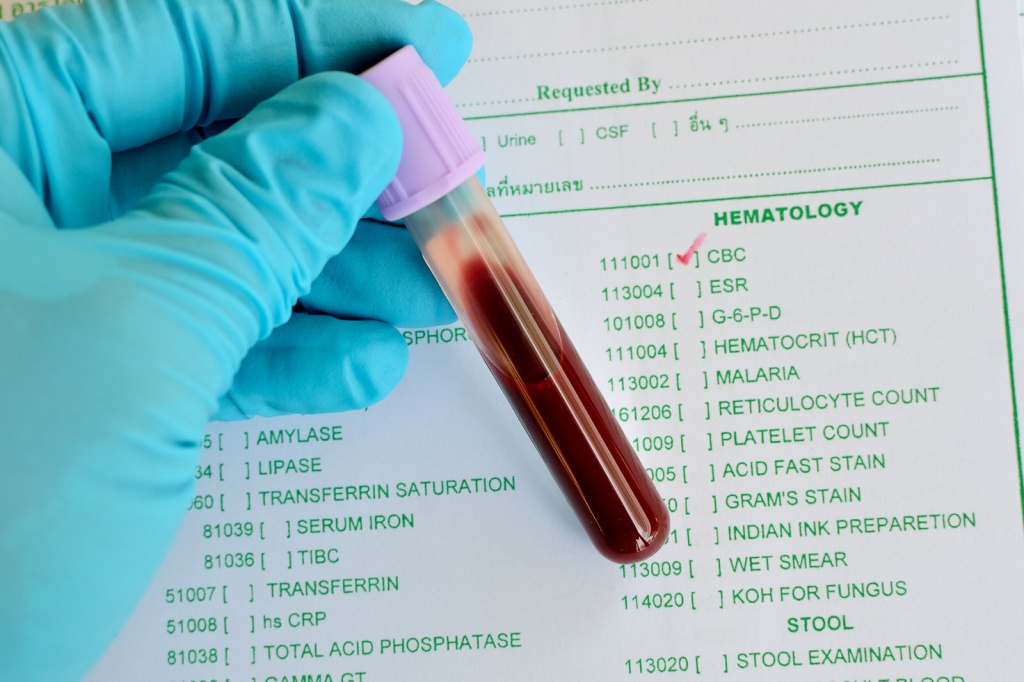 Расшифровка анализа крови на наркотики настройка тор браузера на город hydra