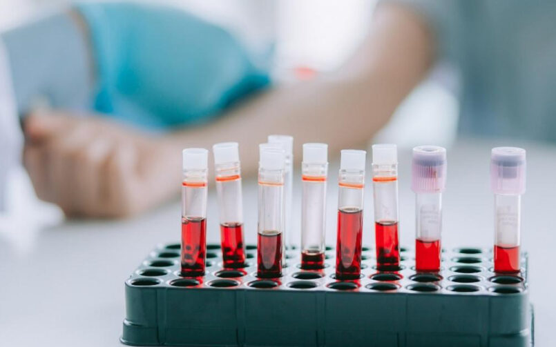 анализ крови на биохимию